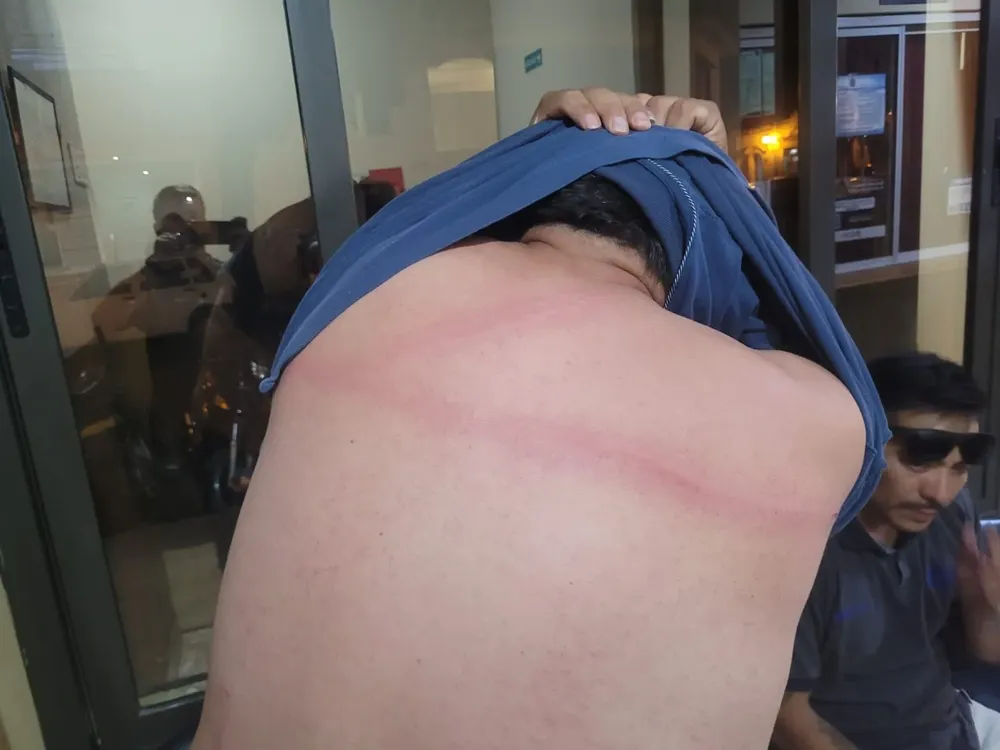 agresion a un inspector municipal